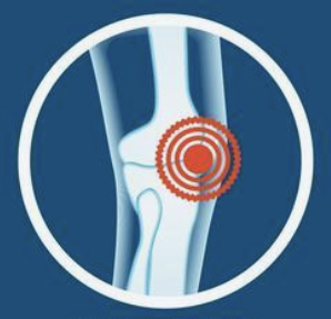 Link to: https://abelhandschiro.com/chiropractor-for-knee-pain